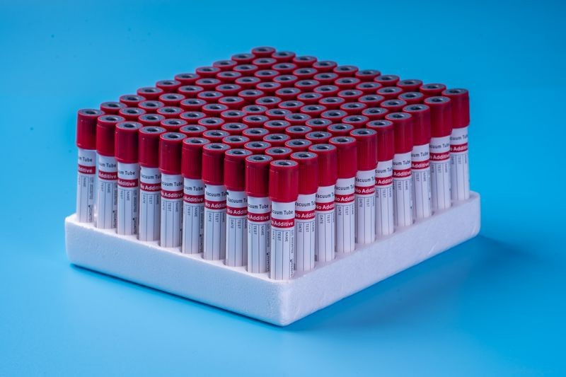 Plain Vacuum Blood Collection Tube suppliers